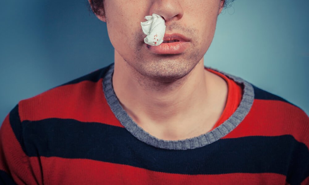 Burun Kanaması Nedir? Kısaca Bilgi