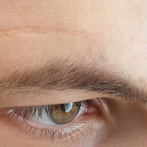 Kabuk Bağlayan Yara Nasıl Geçer? İz Bırakır Mı?